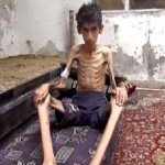 Madaya Ask Someone to Bomb us and Forget About Us
