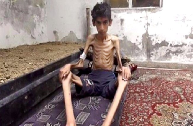 Madaya