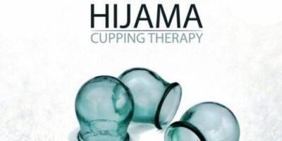Hijama