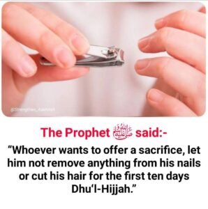 Cutting Nails and Trimming Hair Before Dhul Hijjah (Eid ul-Adha) 2 358ae412 9b5d 452d ba45 e387da6f405b 873 0000135e557eb008 file